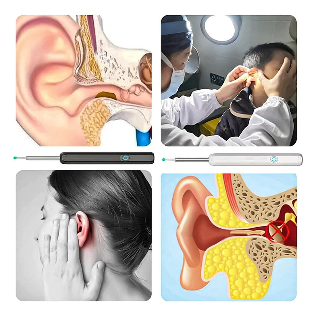 Earwax Removal Kit